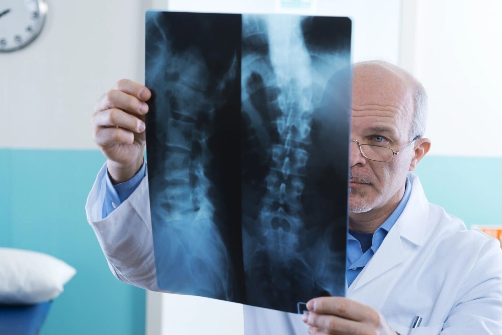 A doctor holding up an x-ray of his back.